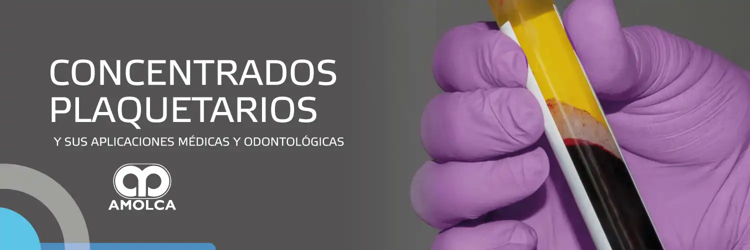 Concentrados plaquetarios y sus aplicaciones médicas y odontológicas