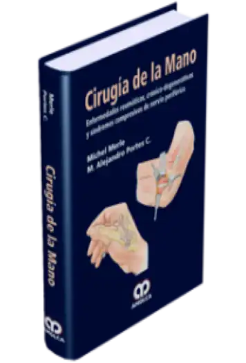 Cirugía de la Mano