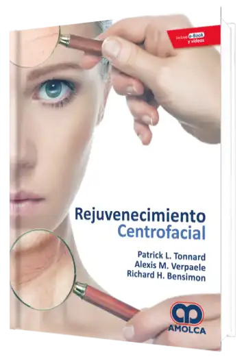 Rejuvenecimiento Centrofacial