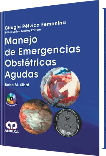 Manejo de Emergencias Obstétricas Agudas