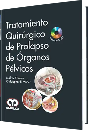 Tratamiento Quirúrgico de Prolapso de Órganos Pélvicos