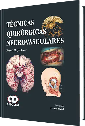 Técnicas Quirúrgicas Neurovasculares