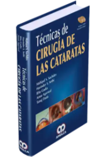 Técnicas de Cirugía de las Cataratas