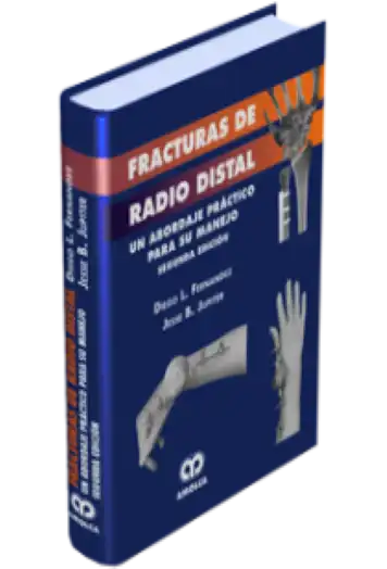 Fracturas de Radio Distal. 2 Edición