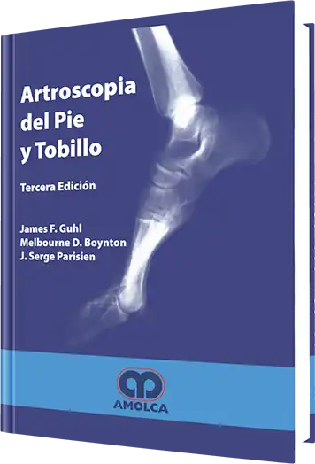 Artroscopia del Pie y Tobillo. 3 Edición