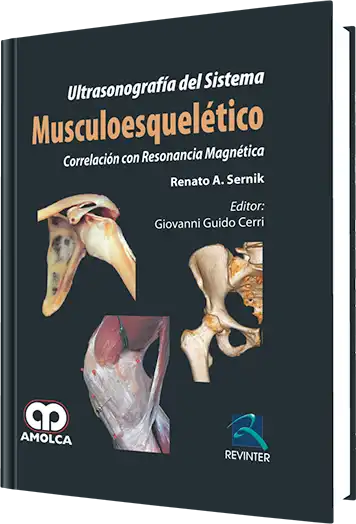 Ultrasonografía del Sistema Musculoesquelético