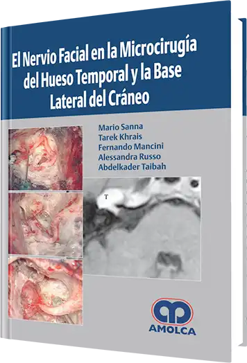 El Nervio Facial en la Microcirugía del Hueso Temporal y la Base Lateral del Cráneo