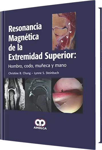 Resonancia Magnética de la Extremidad Superior