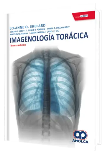 Imagenología Torácica 3 Edición