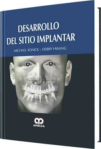 Desarrollo del Sitio Implantar