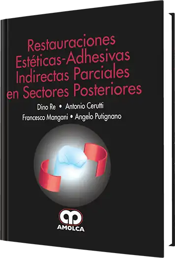 Restauraciones Estéticas-Adhesivas Indirectas Parciales en Sectores Posteriores