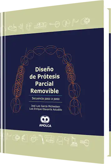 Diseño de Prótesis Parcial Removible