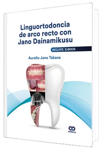 Linguortodoncia de Arco Recto con Jano Dainamikusu