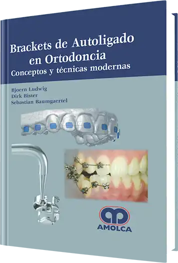 Brackets de Autoligado en Ortodoncia