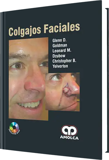 Colgajos Faciales