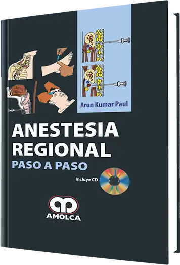 Anestesia Regional Paso a Paso