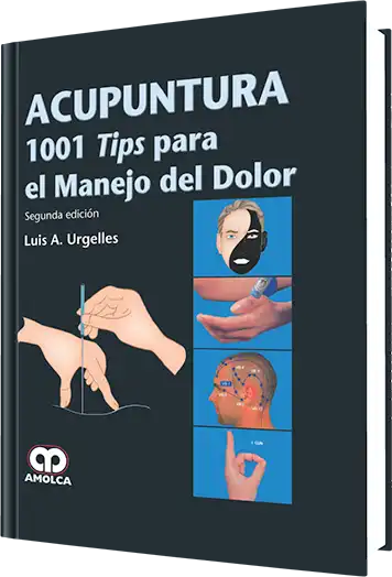 Acupuntura 1001 Tips para el Manejo del Dolor. 2 edición