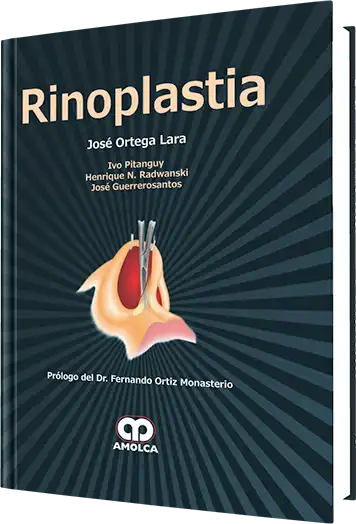 Rinoplastia