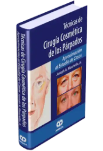 Técnicas de Cirugía Cosmética de los Párpados