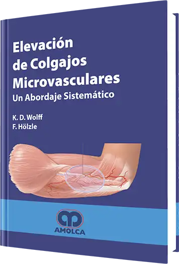 Elevación de Colgajos Microvasculares